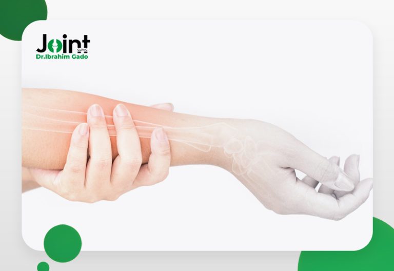 كسور الساعد - Joint Clinic